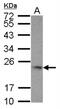 TNF Superfamily Member 9 antibody, NBP2-20673, Novus Biologicals, Western Blot image 
