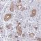 A28-RGS14P antibody, HPA055824, Atlas Antibodies, Immunohistochemistry paraffin image 