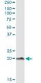 NPC Intracellular Cholesterol Transporter 2 antibody, H00010577-M11, Novus Biologicals, Immunoprecipitation image 