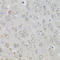 Interleukin 13 antibody, LS-C331885, Lifespan Biosciences, Immunohistochemistry frozen image 