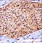 SCY1 Like Pseudokinase 3 antibody, LS-C164572, Lifespan Biosciences, Immunohistochemistry paraffin image 