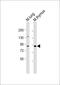 Poly(ADP-Ribose) Polymerase Family Member 9 antibody, 55-972, ProSci, Western Blot image 