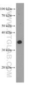 Arginase 1 antibody, 66129-1-Ig, Proteintech Group, Western Blot image 