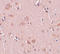 Pleckstrin Homology And RUN Domain Containing M2 antibody, A11280, Boster Biological Technology, Immunohistochemistry frozen image 