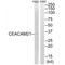 Carcinoembryonic Antigen Related Cell Adhesion Molecule 21 antibody, A16030, Boster Biological Technology, Western Blot image 