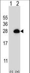 RAB3B, Member RAS Oncogene Family antibody, LS-C162378, Lifespan Biosciences, Western Blot image 