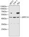 Actin Related Protein 2/3 Complex Subunit 1A antibody, GTX55518, GeneTex, Western Blot image 