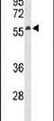 Sestrin 1 antibody, PA5-26881, Invitrogen Antibodies, Western Blot image 