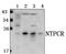 Nucleoside-Triphosphatase, Cancer-Related antibody, PA5-75971, Invitrogen Antibodies, Western Blot image 