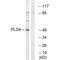 Phospholipase D Family Member 4 antibody, A13908, Boster Biological Technology, Western Blot image 