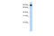 Transmembrane And Tetratricopeptide Repeat Containing 4 antibody, 26-029, ProSci, Enzyme Linked Immunosorbent Assay image 