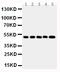 Sphingosine Kinase 1 antibody, PA1996, Boster Biological Technology, Western Blot image 