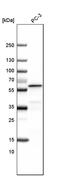 Aldehyde Dehydrogenase 1 Family Member A3 antibody, PA5-61201, Invitrogen Antibodies, Western Blot image 