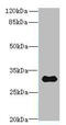 Transmembrane Protein 53 antibody, A63648-100, Epigentek, Western Blot image 