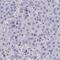 Transmembrane Protein 82 antibody, HPA060282, Atlas Antibodies, Immunohistochemistry paraffin image 