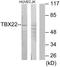 T-Box 22 antibody, TA315436, Origene, Western Blot image 