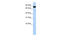 EMAP Like 3 antibody, 27-052, ProSci, Western Blot image 