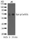 Spleen Associated Tyrosine Kinase antibody, 79-250, ProSci, Western Blot image 