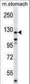 Protein Tyrosine Kinase 2 antibody, LS-C164561, Lifespan Biosciences, Western Blot image 