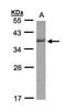Cell Division Cycle 34 antibody, GTX105013, GeneTex, Western Blot image 
