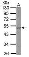 CPEB1 antibody, GTX122410, GeneTex, Western Blot image 