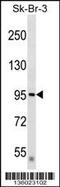 Deltex E3 Ubiquitin Ligase 3L antibody, 58-496, ProSci, Western Blot image 