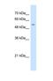 Glycoprotein Nmb antibody, NBP1-69389, Novus Biologicals, Western Blot image 