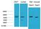 SMAD Family Member 3 antibody, STJ97524, St John