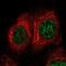 Transforming growth factor beta regulator 1 antibody, NBP2-55805, Novus Biologicals, Immunofluorescence image 