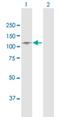 Inter-Alpha-Trypsin Inhibitor Heavy Chain 1 antibody, H00003697-D01P, Novus Biologicals, Western Blot image 