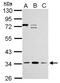 Zinc Finger Protein 124 antibody, NBP2-20961, Novus Biologicals, Western Blot image 