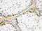 Actin Alpha 1, Skeletal Muscle antibody, RP1070, Boster Biological Technology, Immunohistochemistry paraffin image 