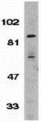 Inhibitor Of Nuclear Factor Kappa B Kinase Subunit Beta antibody, GTX31645, GeneTex, Western Blot image 