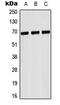 Glycoprotein Ib Platelet Subunit Alpha antibody, MBS821116, MyBioSource, Western Blot image 