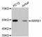 Arrestin Beta 1 antibody, abx125293, Abbexa, Western Blot image 