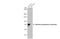 Alkaline Phosphatase, Intestinal antibody, GTX636670, GeneTex, Western Blot image 