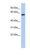 Kelch Like Family Member 7 antibody, NBP1-55462, Novus Biologicals, Western Blot image 