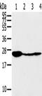 Tumor Protein D52 antibody, TA351837, Origene, Western Blot image 