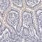 ATP Binding Cassette Subfamily B Member 1 antibody, NBP1-90291, Novus Biologicals, Immunohistochemistry paraffin image 