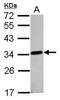 Lactamase Beta 2 antibody, GTX122755, GeneTex, Western Blot image 