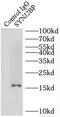 Synaptojanin 2 Binding Protein antibody, FNab08439, FineTest, Immunoprecipitation image 