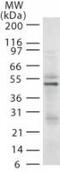 E3 ubiquitin-protein ligase RAD18 antibody, TA336384, Origene, Western Blot image 