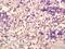 CRACC antibody, GTX37440, GeneTex, Immunohistochemistry paraffin image 