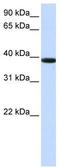 Kelch Domain Containing 8B antibody, TA346662, Origene, Western Blot image 