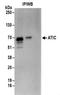 5-Aminoimidazole-4-Carboxamide Ribonucleotide Formyltransferase/IMP Cyclohydrolase antibody, NBP2-32183, Novus Biologicals, Immunoprecipitation image 