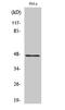 Zinc Finger Protein 174 antibody, STJ91790, St John
