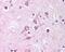 AF4/FMR2 Family Member 1 antibody, 49-658, ProSci, Immunohistochemistry paraffin image 