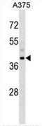 Snurportin 1 antibody, AP53970PU-N, Origene, Western Blot image 