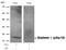 Stathmin 1 antibody, GTX50269, GeneTex, Western Blot image 