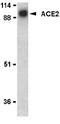 Angiotensin I Converting Enzyme 2 antibody, AP22858PU-N, Origene, Western Blot image 